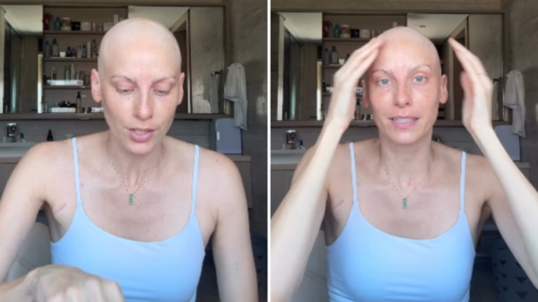 Atriz Dani Gondim se emociona ao falar sobre tratamento contra o câncer: "Sou privilegiada"