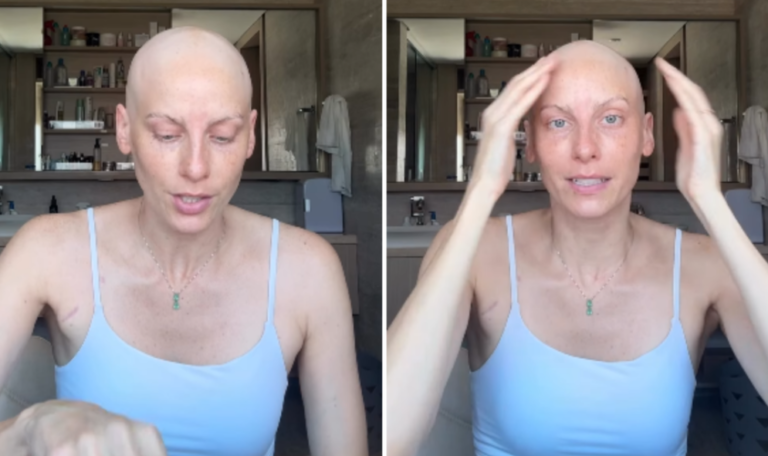 Atriz Dani Gondim se emociona ao falar sobre tratamento contra o câncer: "Sou privilegiada"