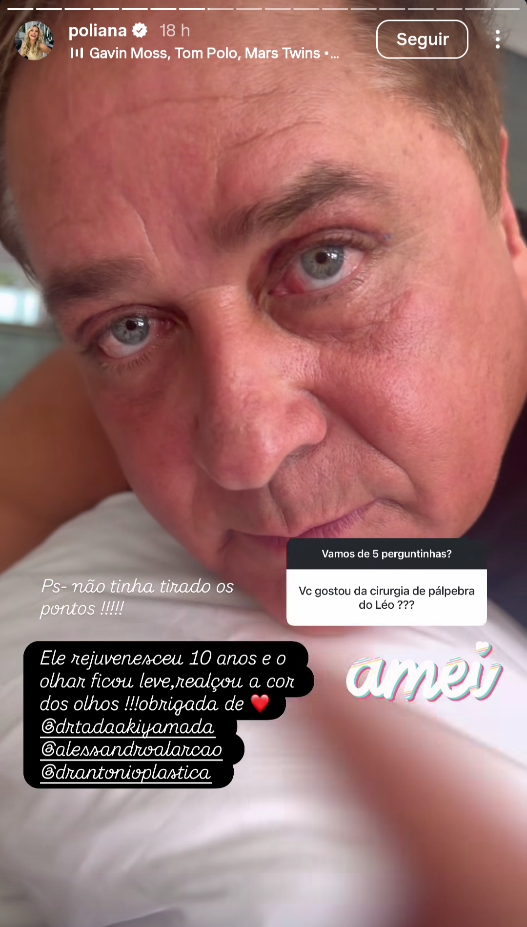 Veja o resultado de cirurgia estética facial de Leonardo