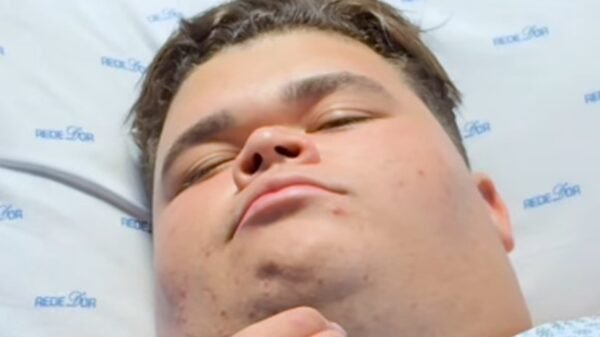 Gordão da XJ passa por cirurgia após perder mais de 130 kg