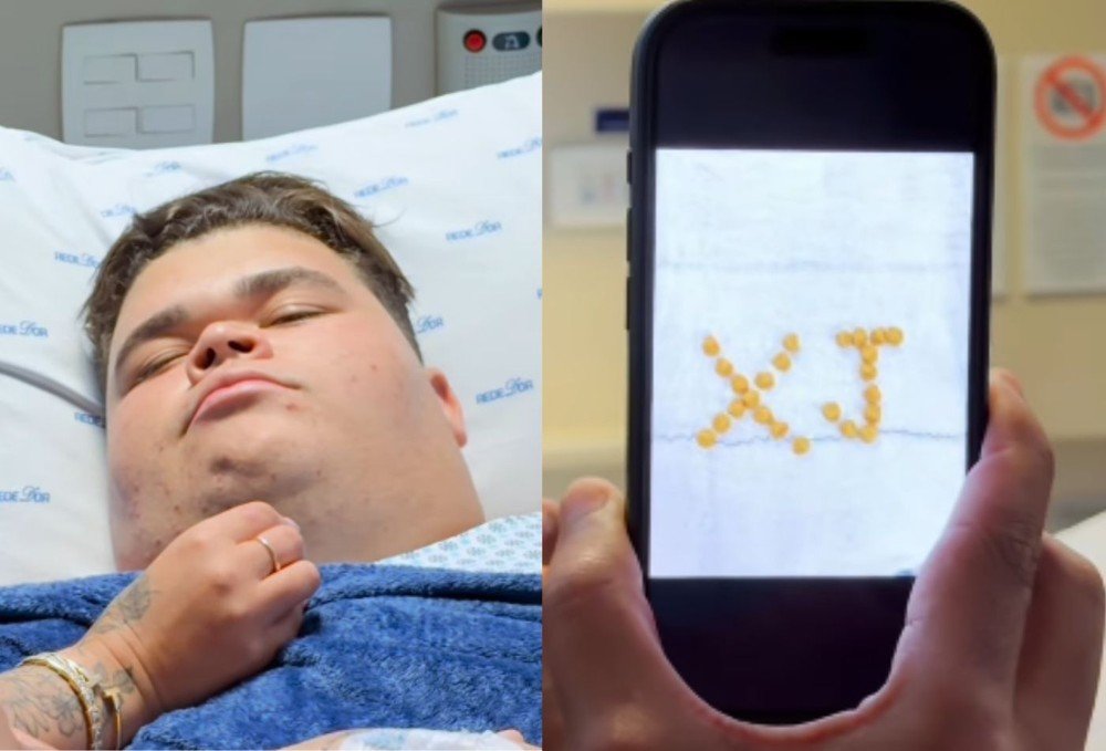 Gordão da XJ passa por cirurgia após perder mais de 130 kg