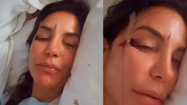 ivete sangalo rosto machucado