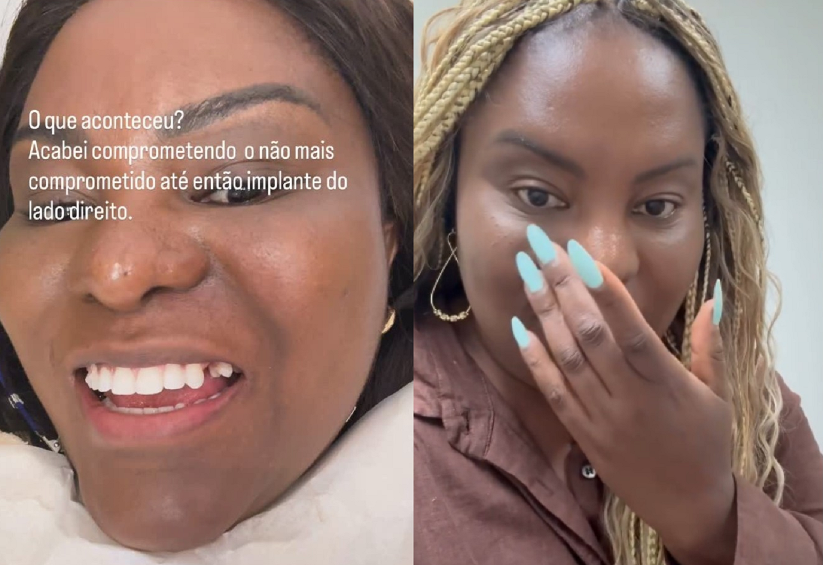 karin hills quebra dente