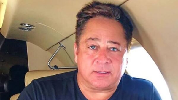 Veja o resultado de cirurgia estética facial de Leonardo