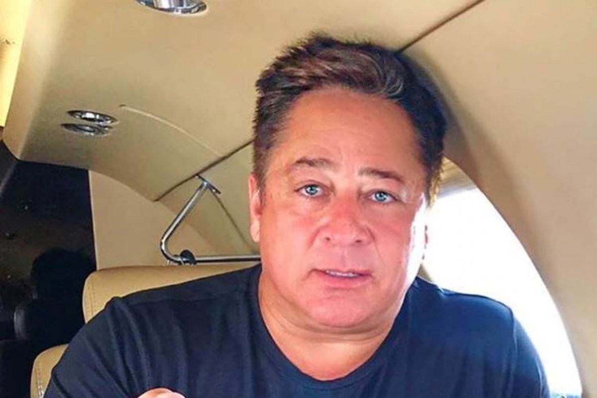 Veja o resultado de cirurgia estética facial de Leonardo