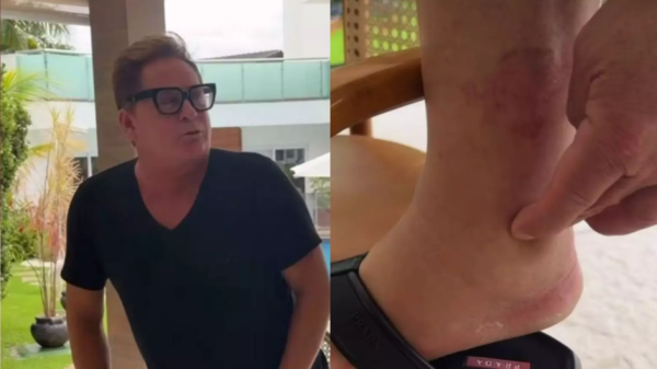 Leonardo viraliza ao brincar sobre pé inchado, culpa a cachaça e arranca risadas da web