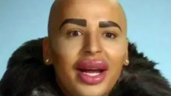 rei dos labios morre