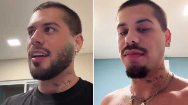 ze felipe se machuca mudar visual