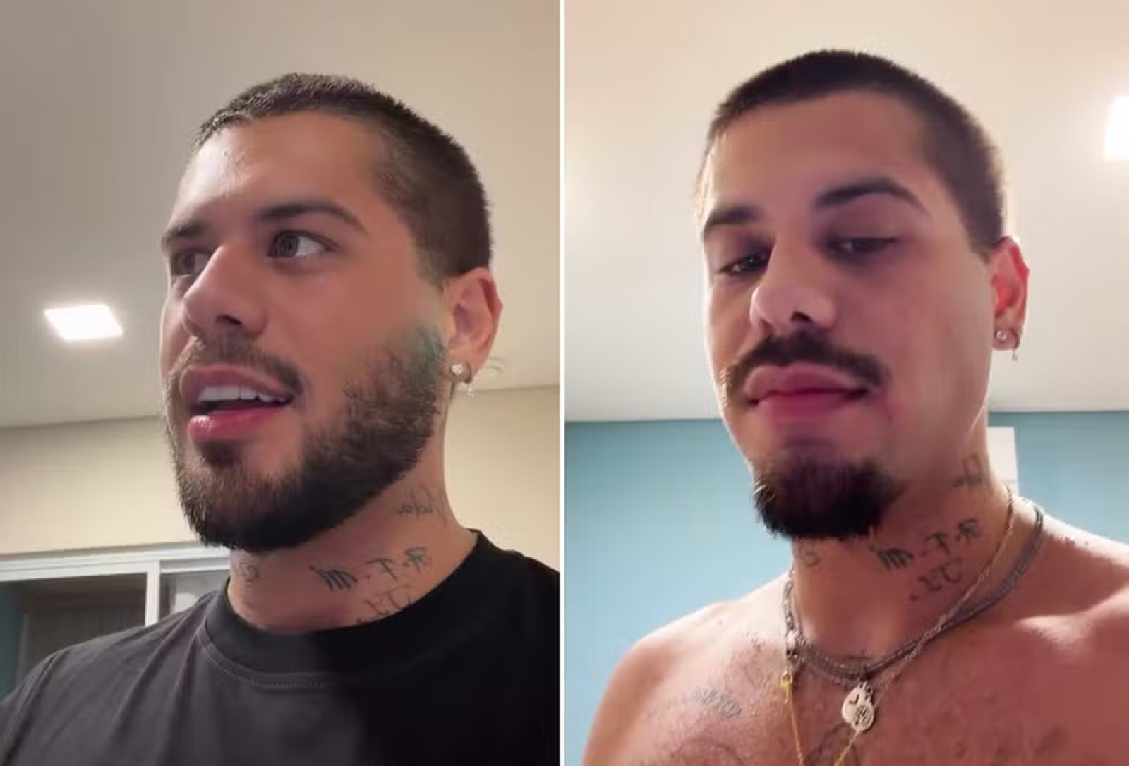 ze felipe se machuca mudar visual