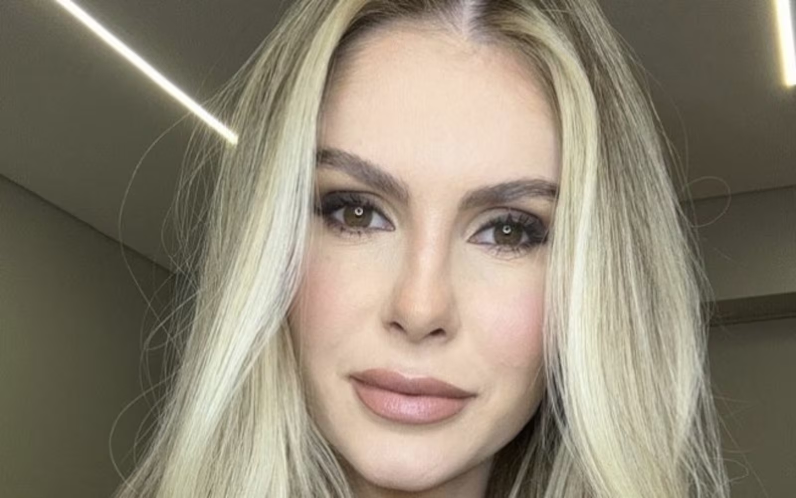 Bárbara Evans detalha cirurgia abdominal e expõe cicatriz após abdominoplastia