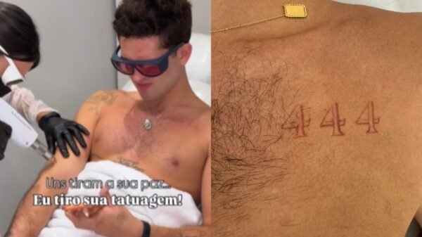 João Guilherme inicia remoção de tatuagens e adota fase mais “clean” no visual 1 design sem nome 17