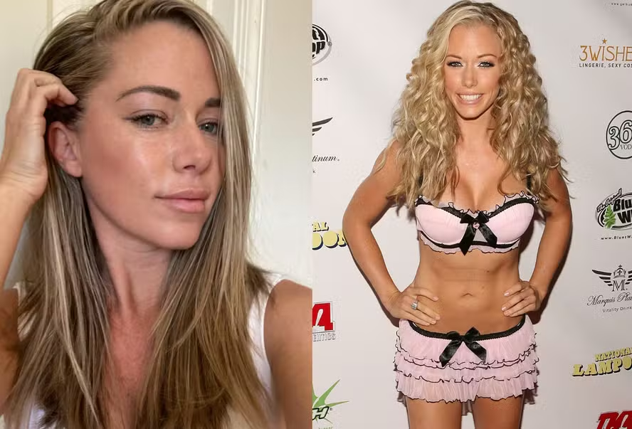 Kendra Wilkinson agora e antes — Foto: Reprodução/Instagram e Getty Images