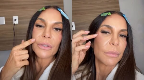 ivete rosto atualizacoes