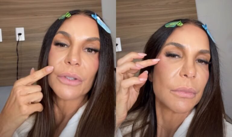 ivete rosto atualizacoes
