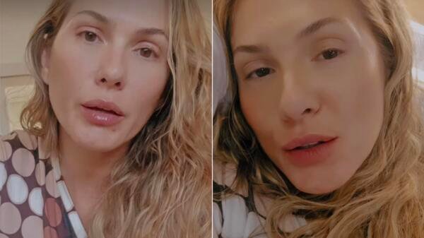 Saiba o estado de saúde de Lívia Andrade após cirurgia causada por dor intensa 2 livia andrade