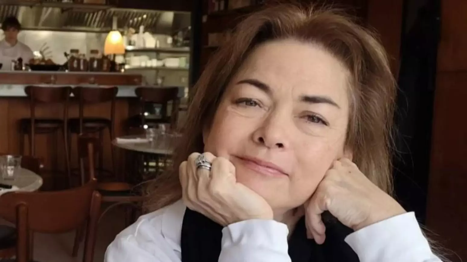 Um a irritação no olho acabou sendo o primeiro sinal de uma doença hepática rara para Caroline King, 63 - Foto: Reprodução