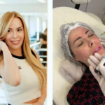 Ju Isen revela ter feito plásticas por influência das redes sociais após exposição na TV