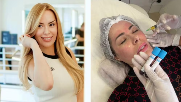 Ju Isen revela ter feito plásticas por influência das redes sociais após exposição na TV