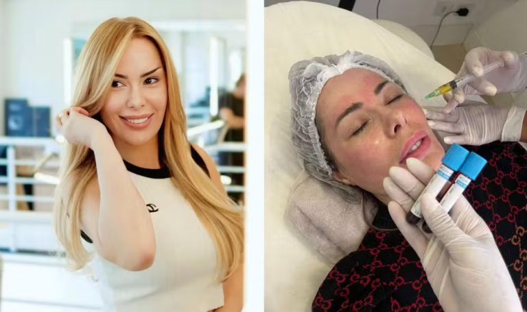 Ju Isen revela ter feito plásticas por influência das redes sociais após exposição na TV