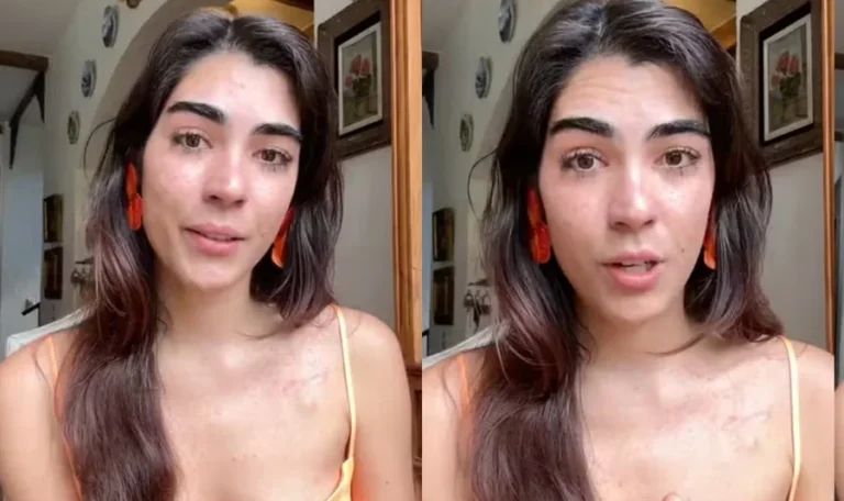 Cantora Ananda Paixão revela terceiro diagnóstico de câncer aos 28 anos e emociona seguidores 47 ananda paixao