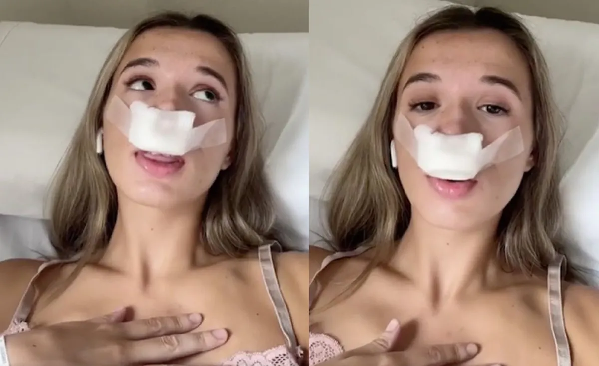 rinoplastia Fiore Ciminello