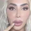 farrah abraham unable to open her mouth after plastic