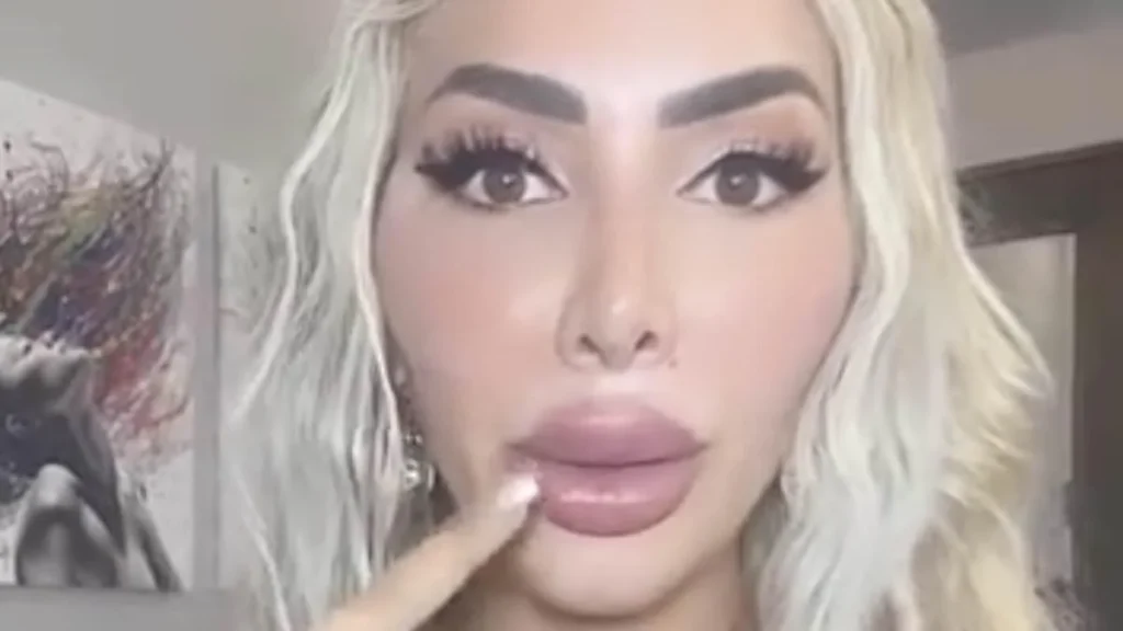 farrah abraham unable to open her mouth after plastic