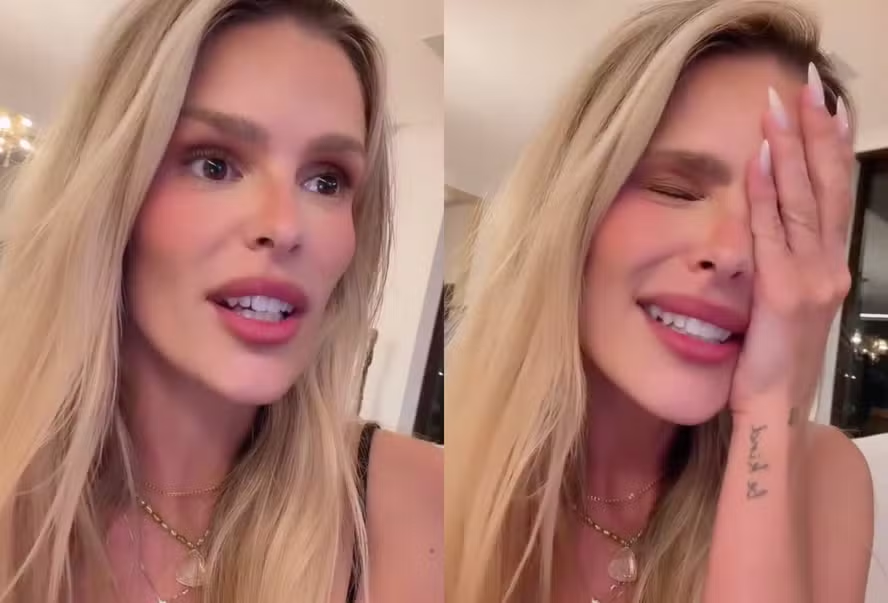 Yasmin Brunet revela que morador de rua percebeu sinais de lipedema antes dos médicos 47 image