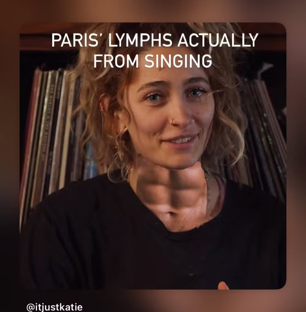 Paris Jackson faz ultrassom após fãs apontarem “aparência estranha” em seu pescoço 47 image