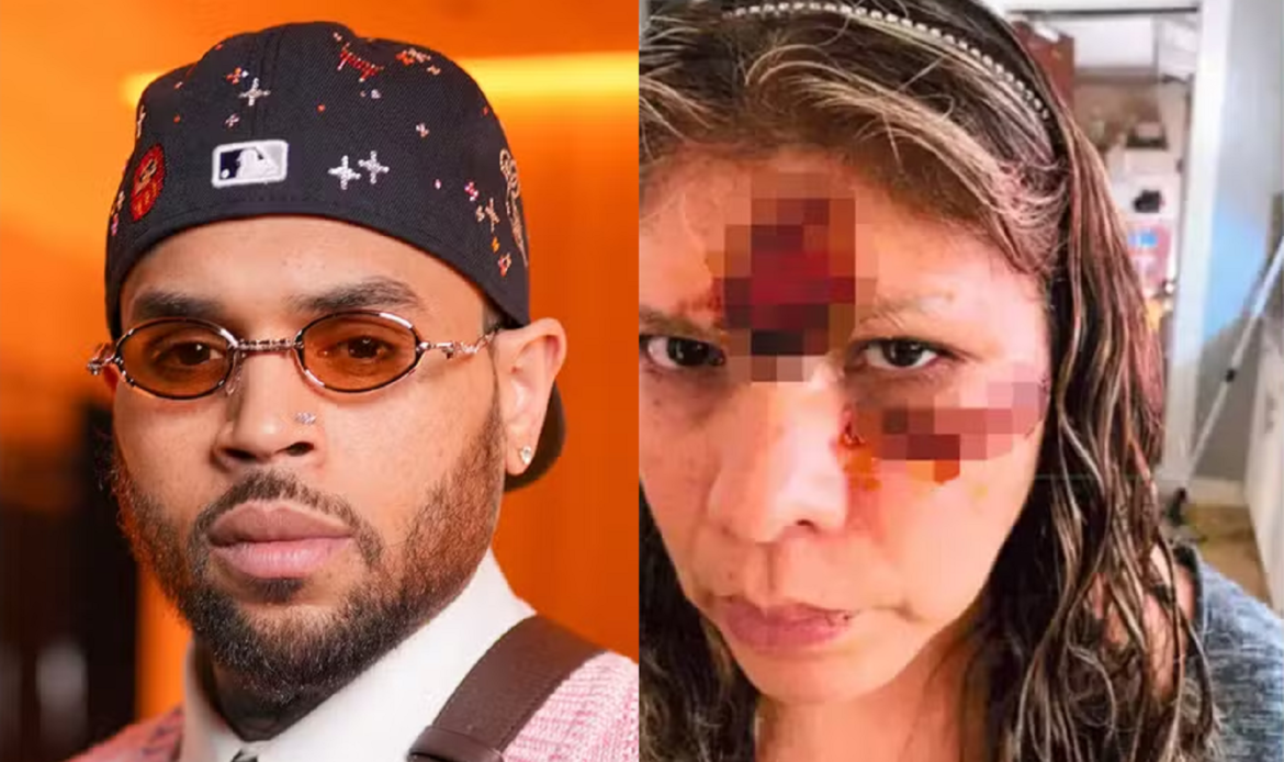 Chris Brown é condenado a indenizar ex-funcionária em R$ 67 milhões após ataque de cachorro 47 chris brown processo anulado