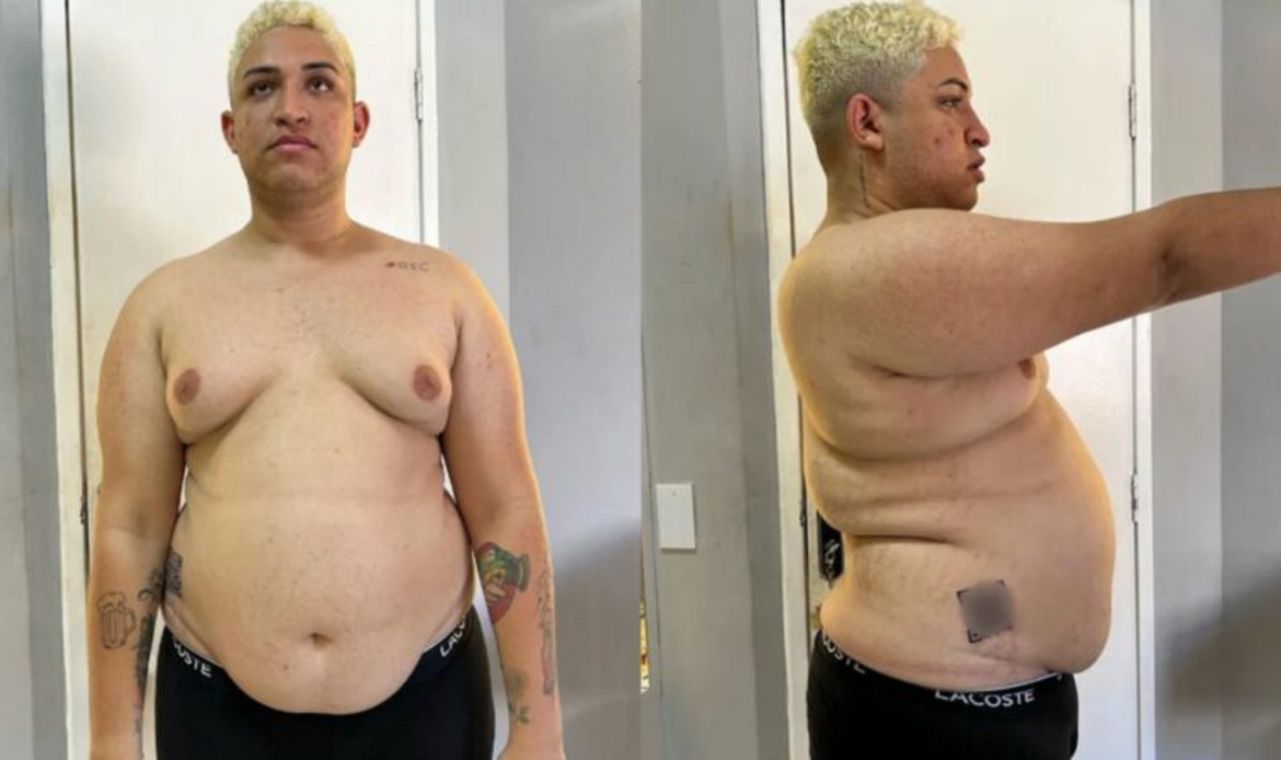 Influenciador vira "padrão" após perder quase 50 kg; veja 48 yarley