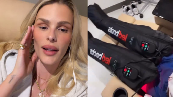 Yasmin Brunet relata crise de lipedema após consumo de glúten 1 yasmin brunet crise lipedema