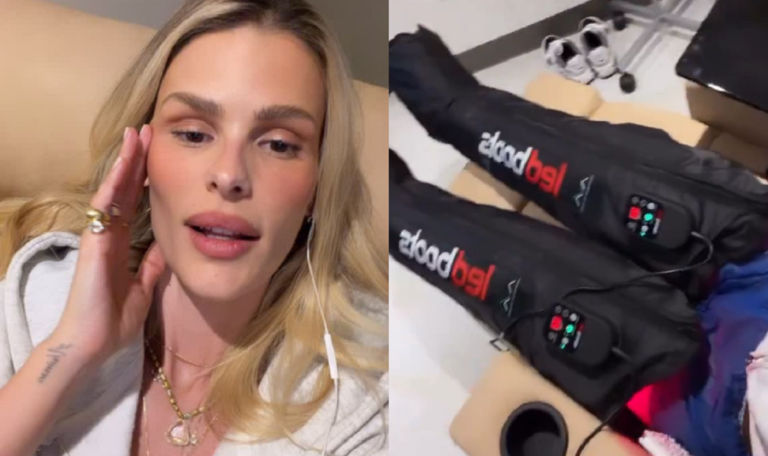 Yasmin Brunet relata crise de lipedema após consumo de glúten 48 yasmin brunet crise lipedema