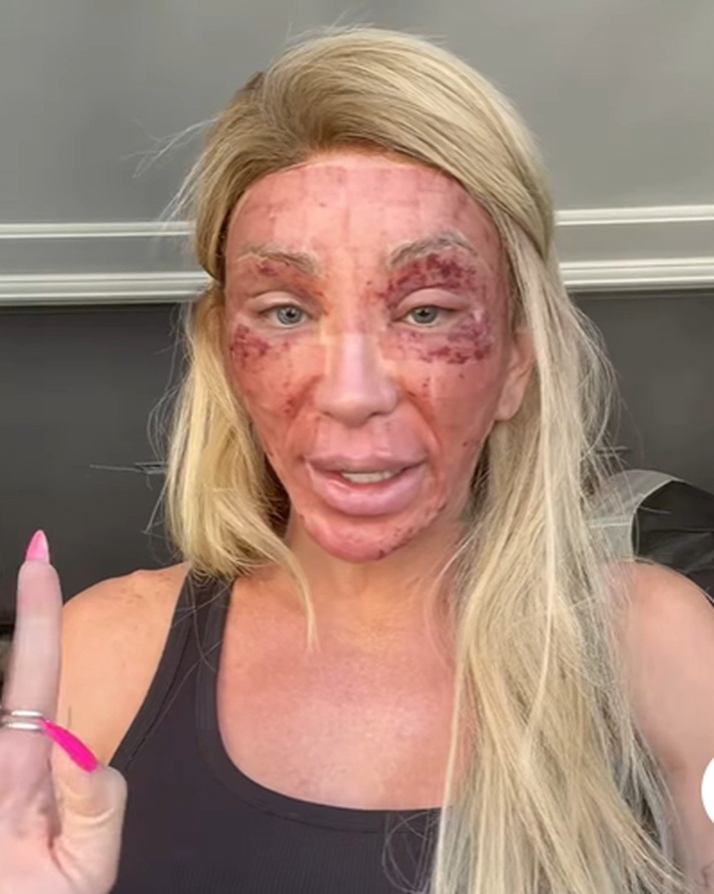 Maya Massafera mostra rosto inchado após peeling e tranquiliza seguidores sobre recuperação 48 captura de tela 2026 07 16 094345
