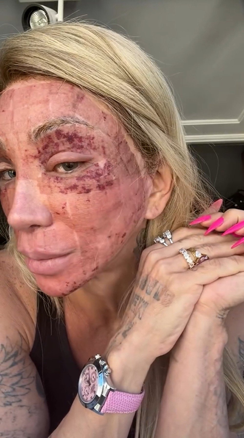 Maya Massafera mostra rosto inchado após peeling e tranquiliza seguidores sobre recuperação 47 captura de tela 2026 07 16 095956