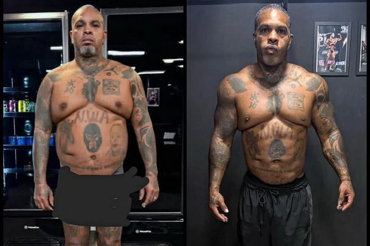 Rodriguinho passa por cirurgia reparadora após perder 20 kg; veja fotos 48 image