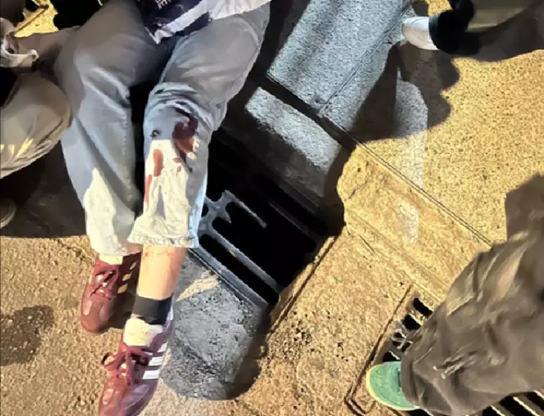 Fã de Harry Styles sofre acidente ao deixar show em São Paulo e leva 30 pontos na perna 47 image