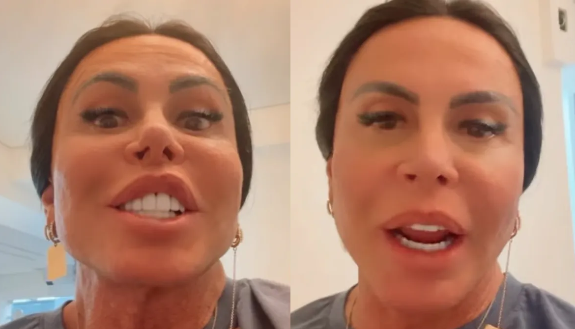 Gretchen rebate críticas sobre procedimento estético: "Meu marido gosta" 47 image