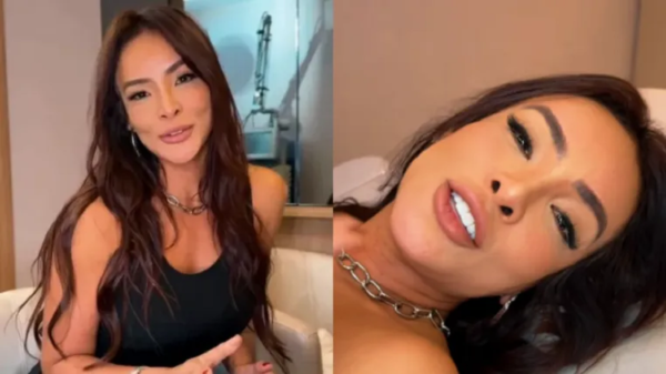 Carol Nakamura revela procedimento em região íntima