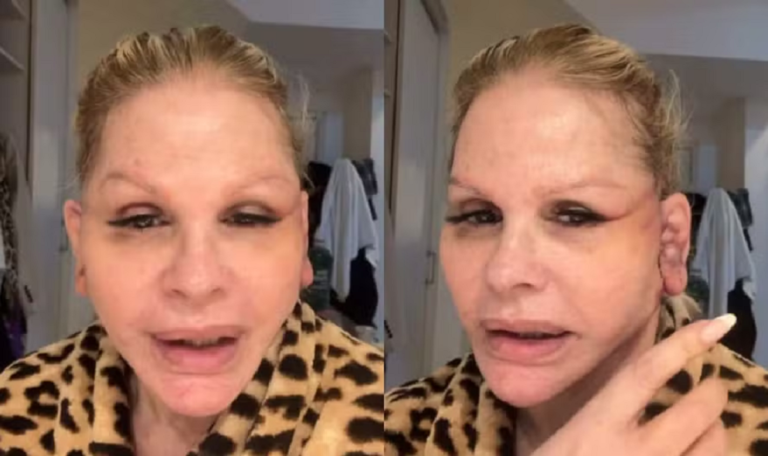 Monique Evans atualiza recuperação após cirurgia facial e diz que banco não reconheceu seu rosto 48 Monique Evans