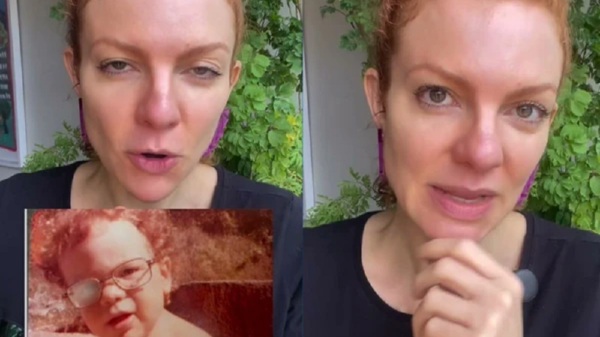 Vídeo: atriz revela ser "quase cega de um olho" 1 atriz quase cega olho