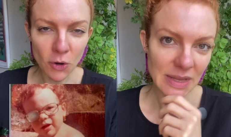 Vídeo: atriz revela ser "quase cega de um olho" 51 atriz quase cega olho