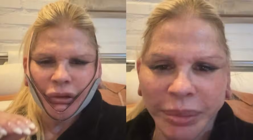 Monique Evans atualiza recuperação após cirurgia facial e diz que banco não reconheceu seu rosto 47 image