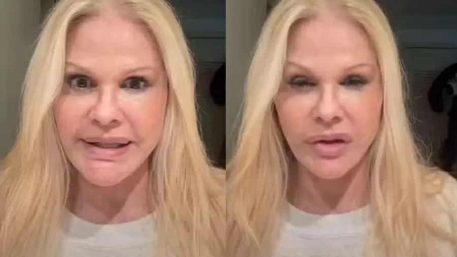 Monique Evans exibe resultado de minilifting facial: "Estou chocada"; veja 47 image