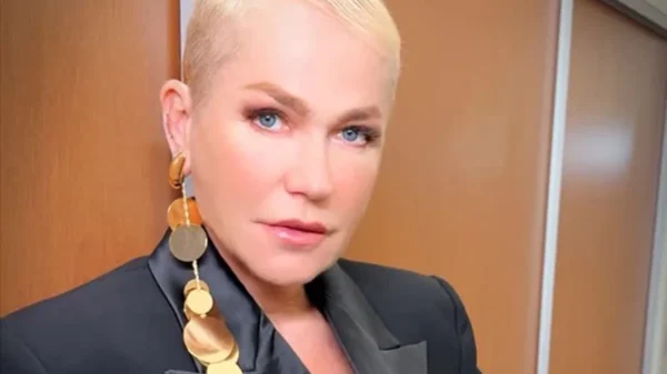 Fãs relembram rinoplastia de Xuxa com médico cubano que acabou preso 1 xuxa rinoplastia medico cubano preso