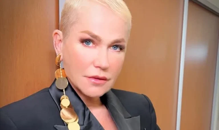 Fãs relembram rinoplastia de Xuxa com médico cubano que acabou preso 47 xuxa rinoplastia medico cubano preso