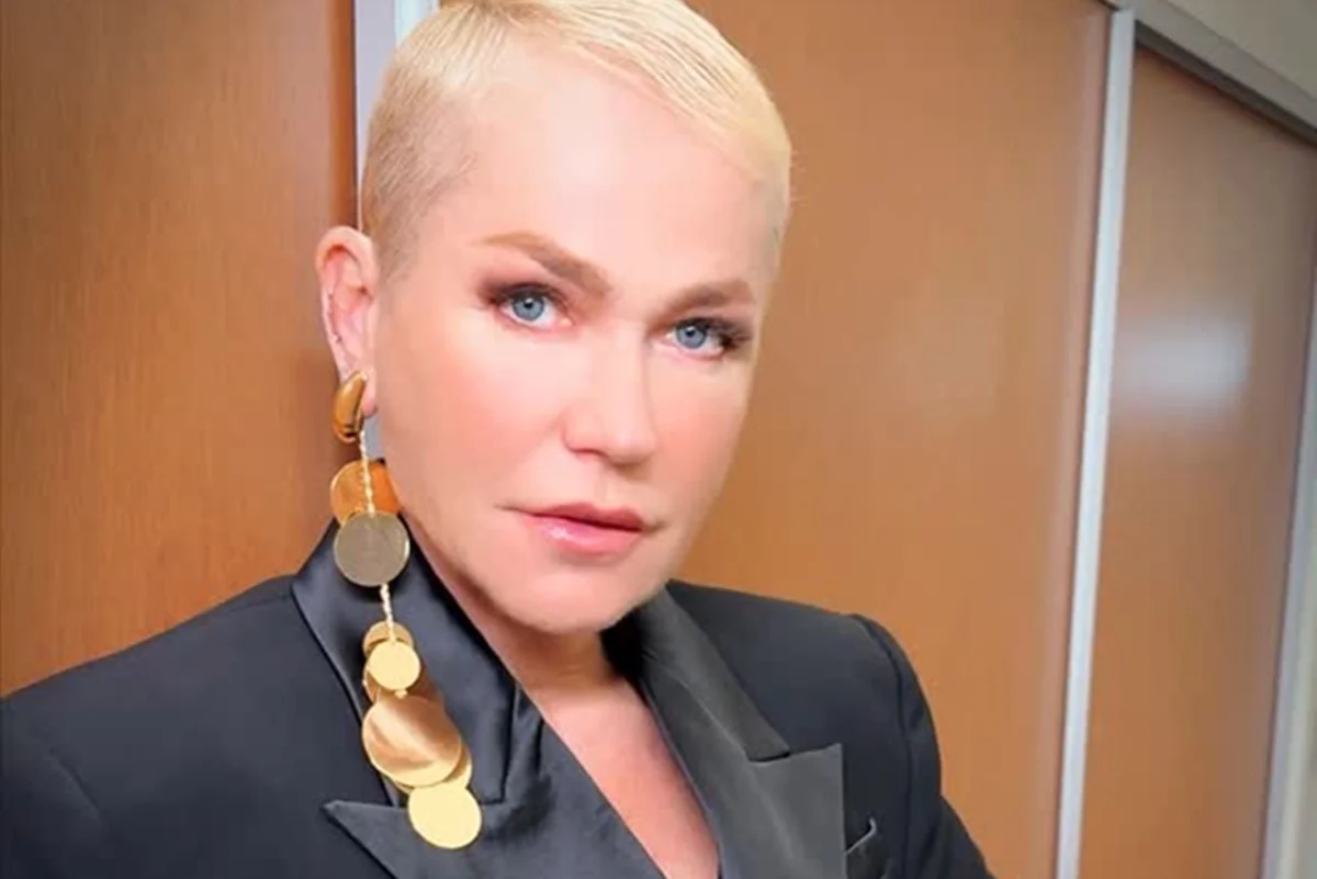 xuxa rinoplastia medico cubano preso