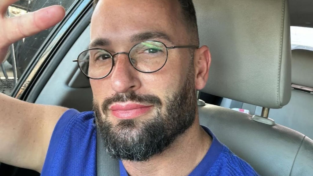 Diego Hypolito mostra antes e depois de procedimentos estéticos