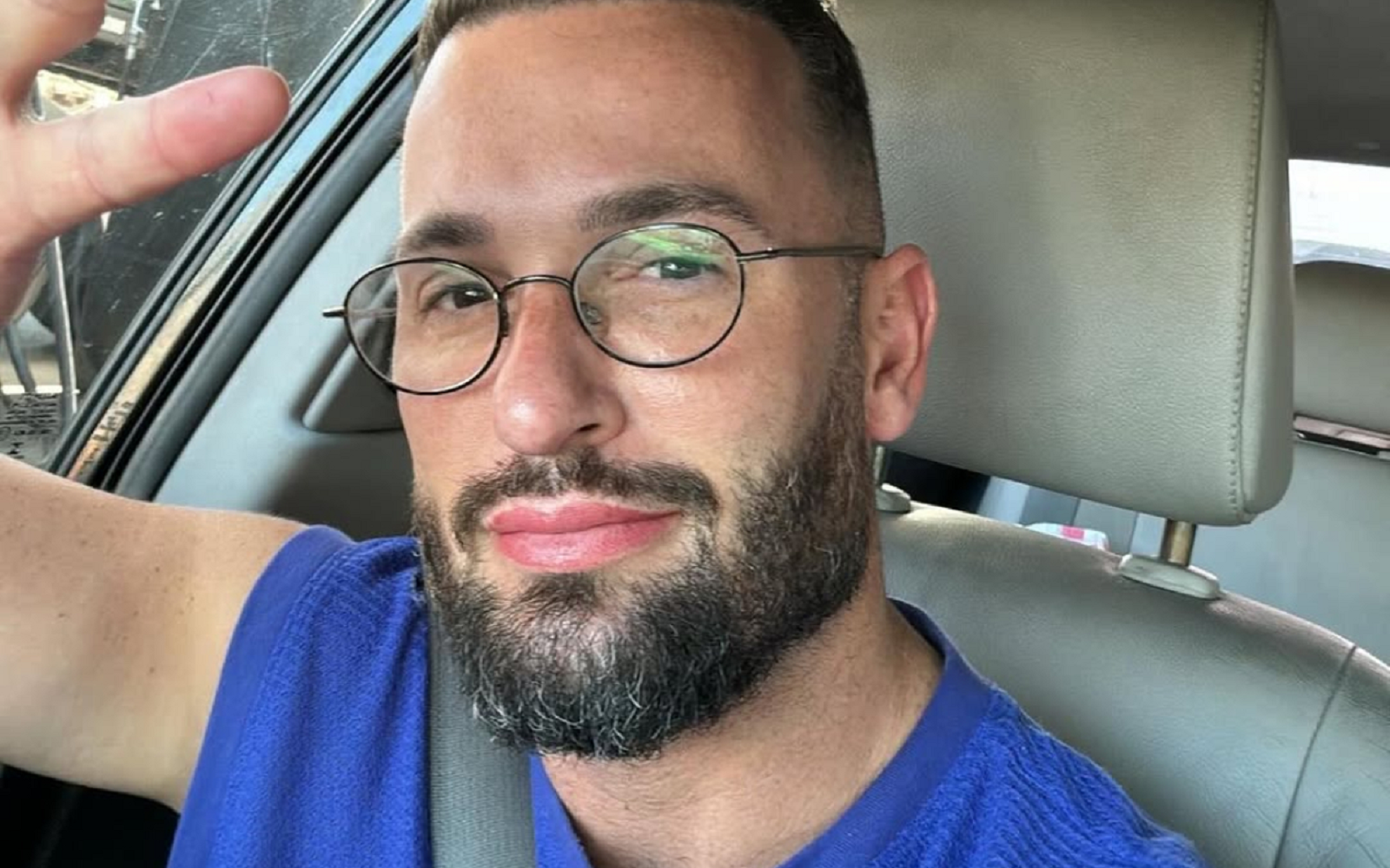 Diego Hypolito mostra antes e depois de procedimentos estéticos