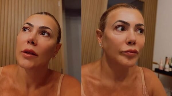 Influenciadora Fabiana Teixeira revela diagnóstico de cisto no cérebro e relata desespero 2 fabiana teixeira cisto cerebro